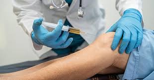 Joint effusion