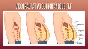 Increased fat