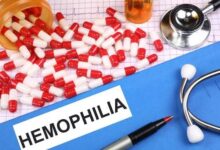 hemophilia